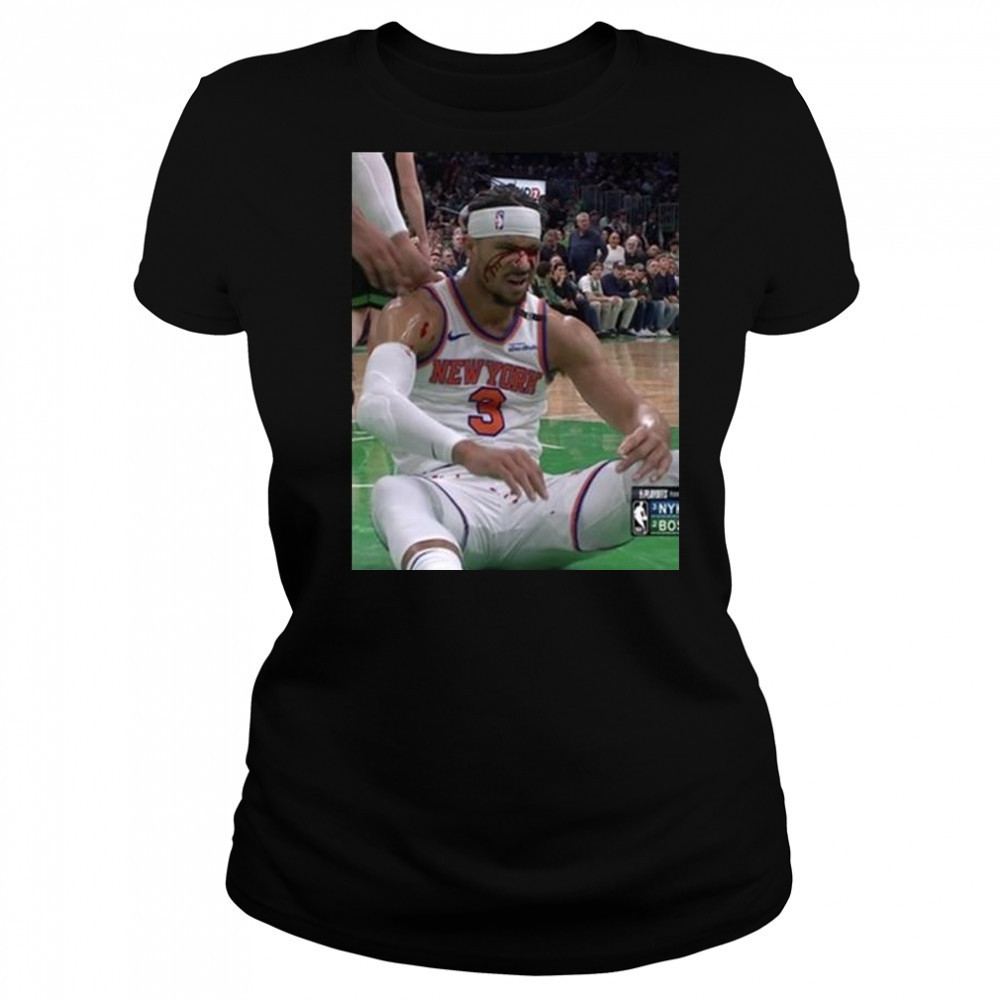Photos Of Josh Hart After Getting Elbowed In The Face New York Knicks t-shirt Women's T-shirt