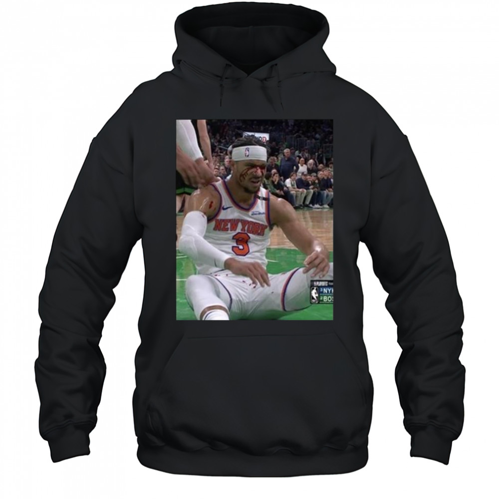 Photos Of Josh Hart After Getting Elbowed In The Face New York Knicks t-shirt Hoodie