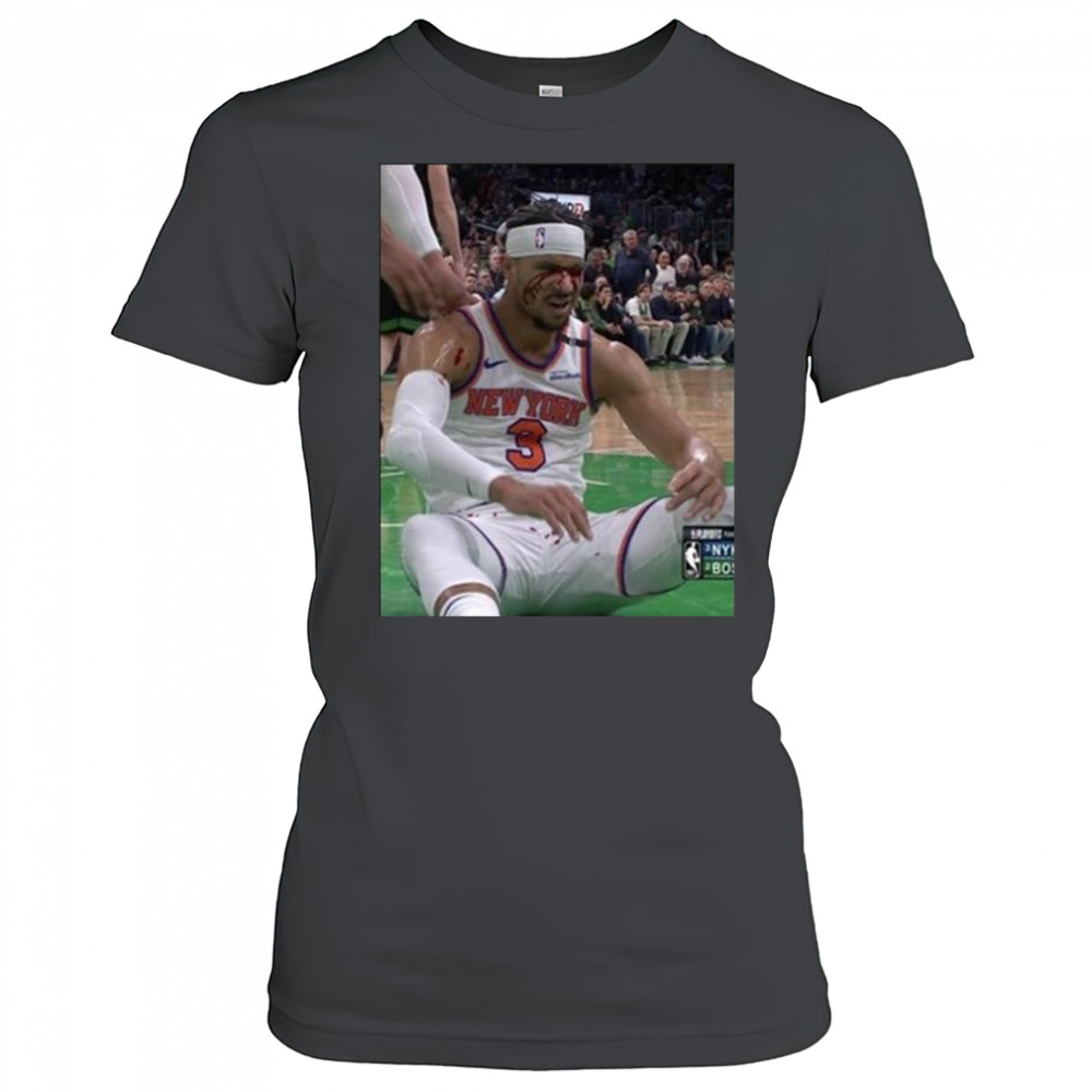 Photos Of Josh Hart After Getting Elbowed In The Face New York Knicks t-shirt Women's T-shirt