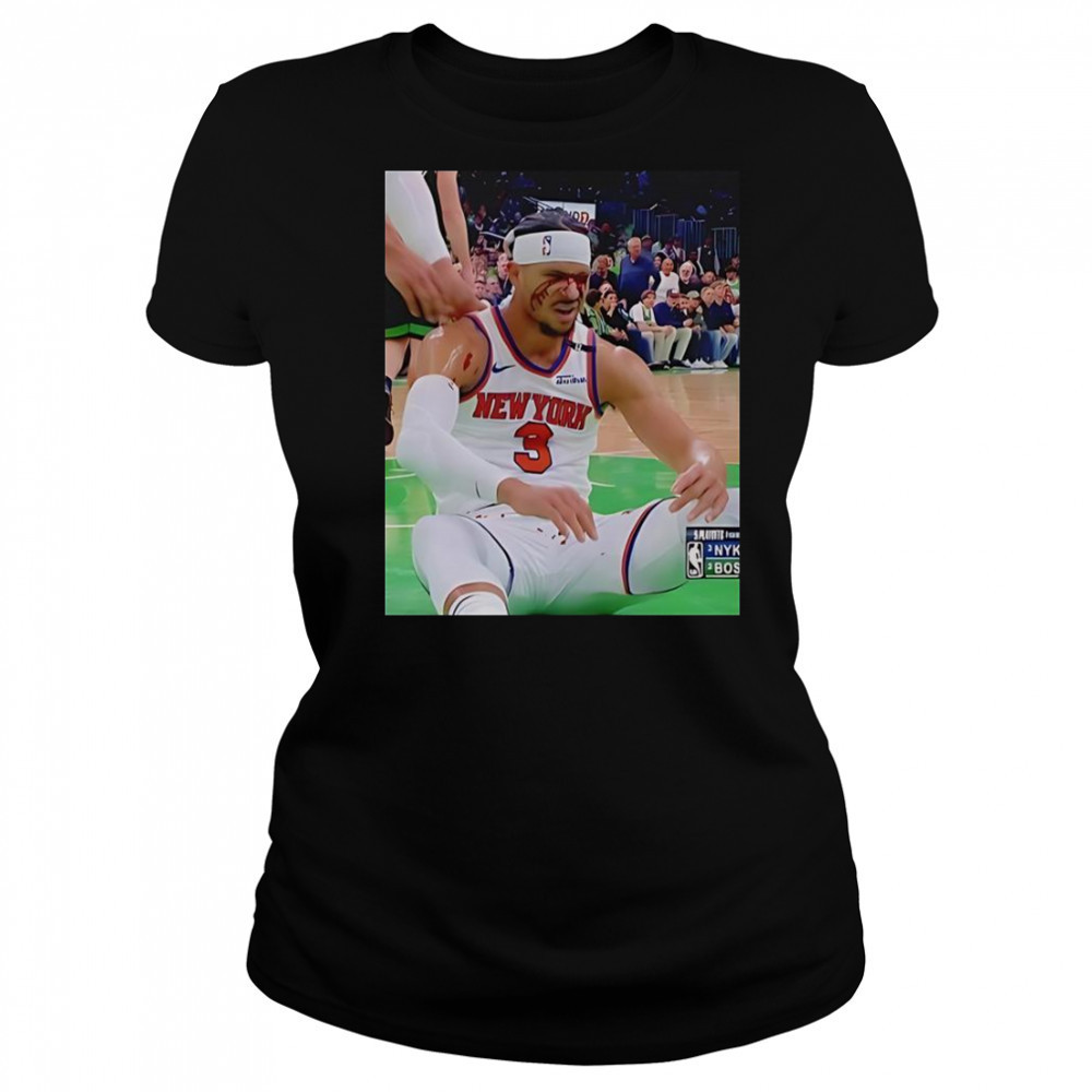 Photos Of Josh Hart After Getting Elbowed In The Face T-Shirt Women's T-shirt