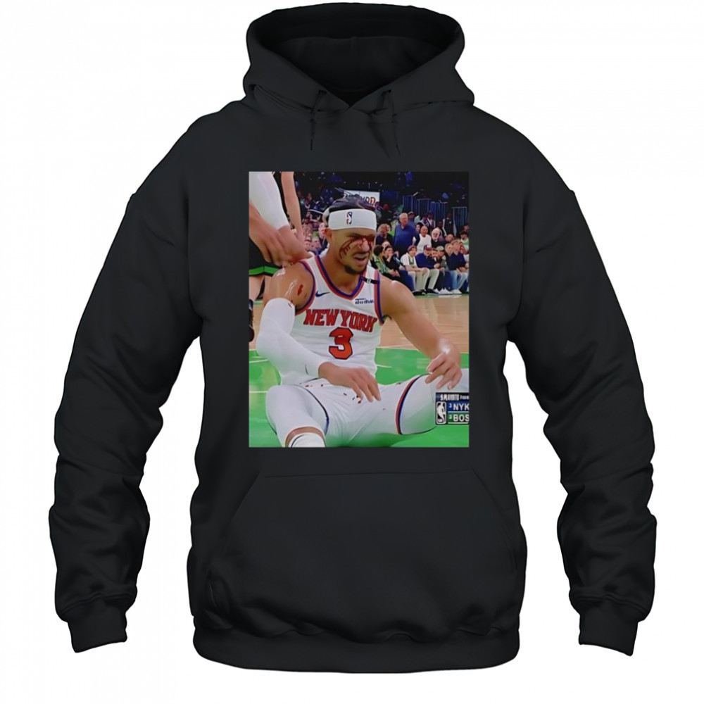 Photos Of Josh Hart After Getting Elbowed In The Face T-Shirt Hoodie