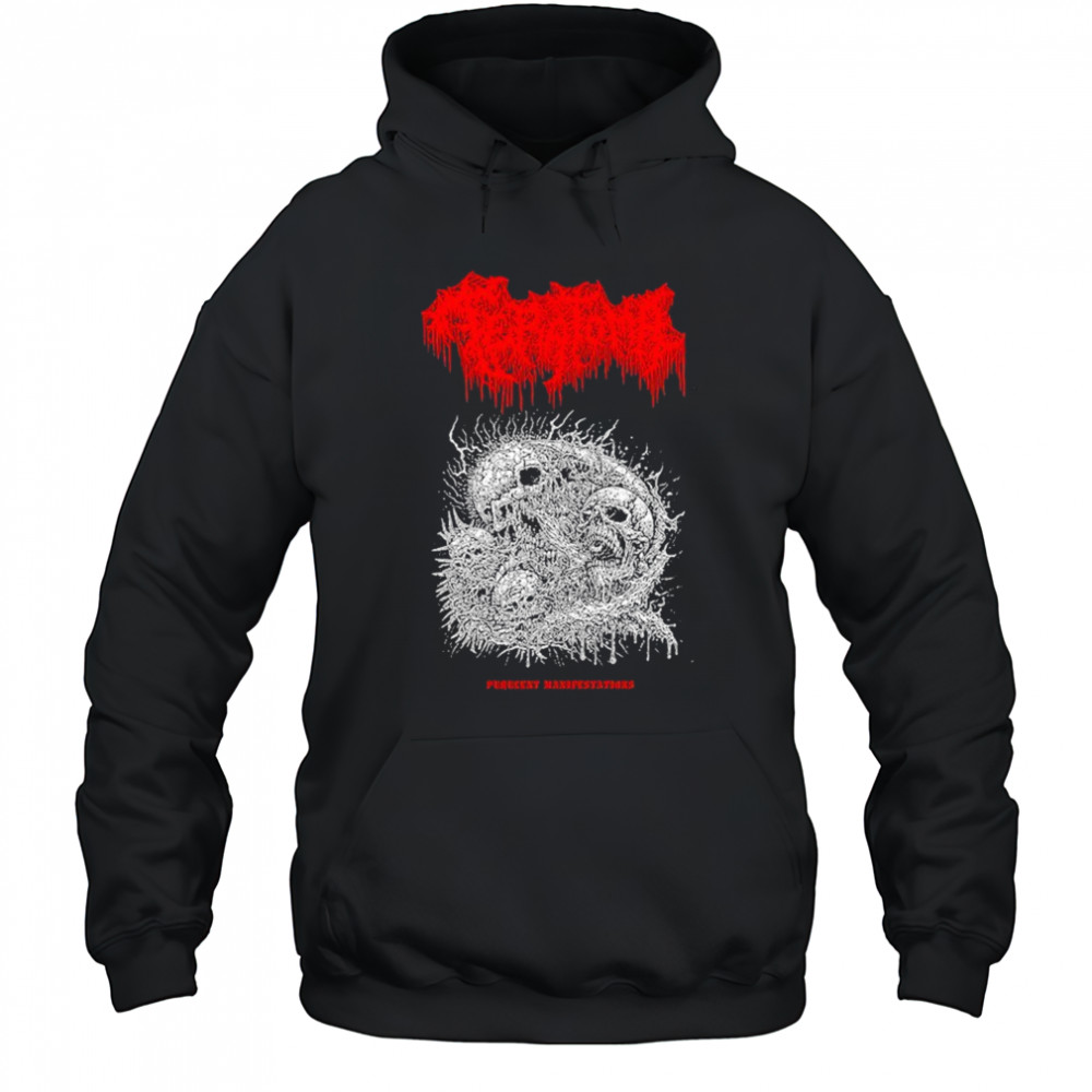 Teratoma Manifestations T-shirt Hoodie