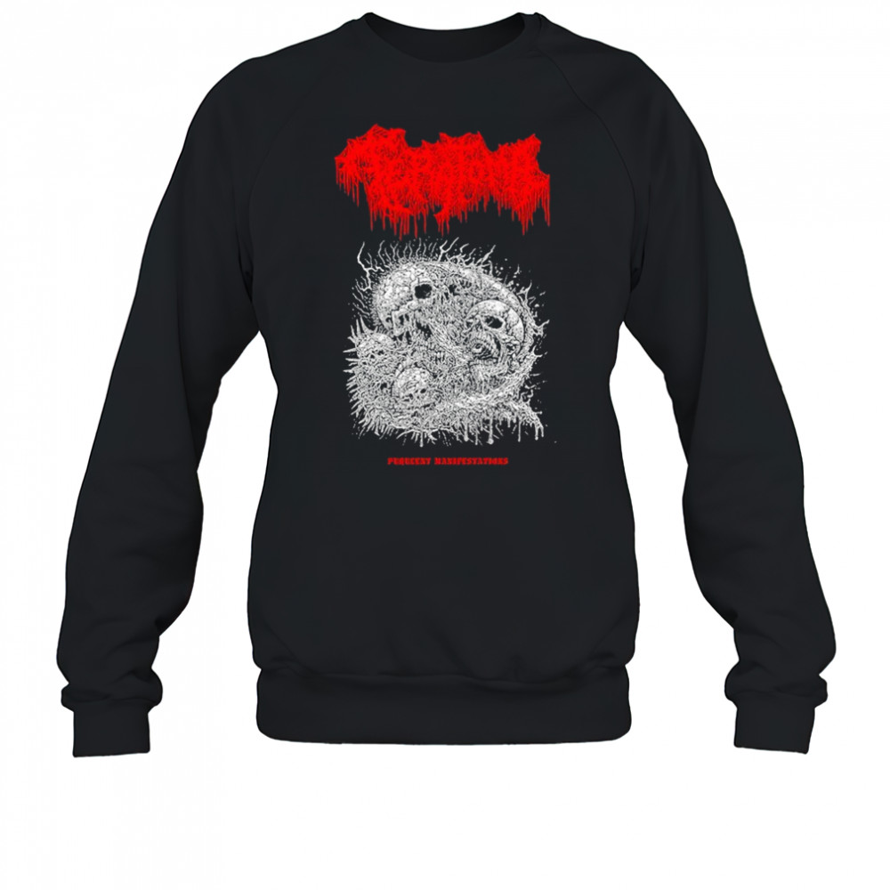 Teratoma Manifestations T-shirt Sweatshirt
